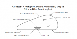 Natrelle schematics - side view of the breast implant (style 410)