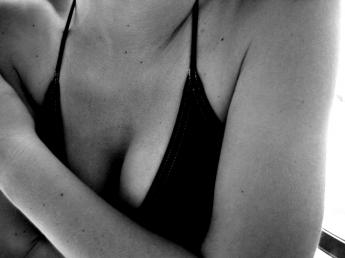 Picture of Model for Breast Augmentation web page, not actual patient